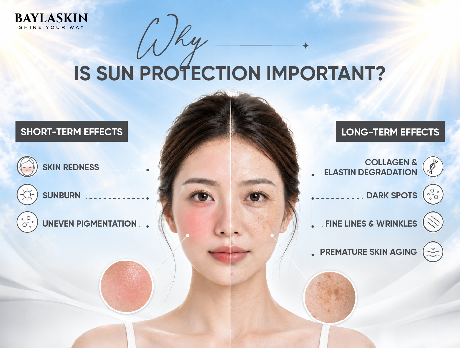 Why Is Suncream Important? Short-Term and Long-Term Impacts of UV Rays on The Skin
